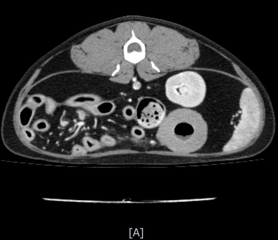 종양 진단을 위한 영상 검사 예시 이미지