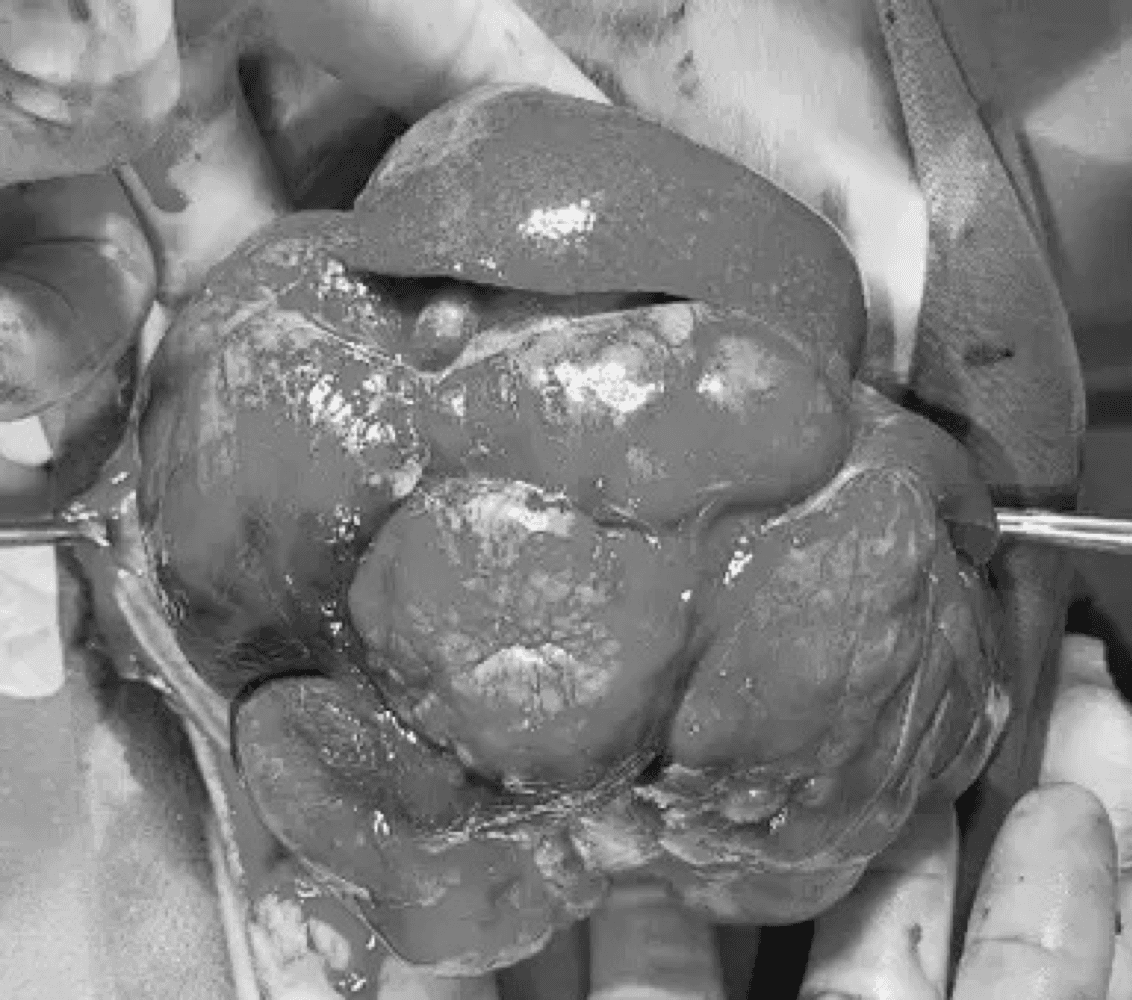 종양 치료 예시 이미지 3