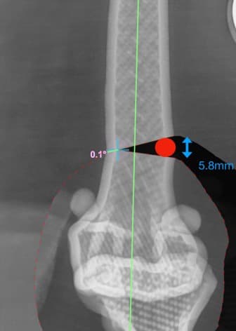 슬개골 탈구 및 DFO 수술 예시 이미지 4
