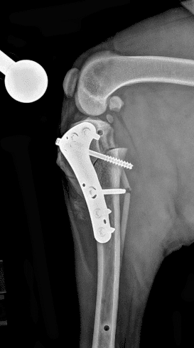십자인대교정 CBLO 수술 예시 이미지 1